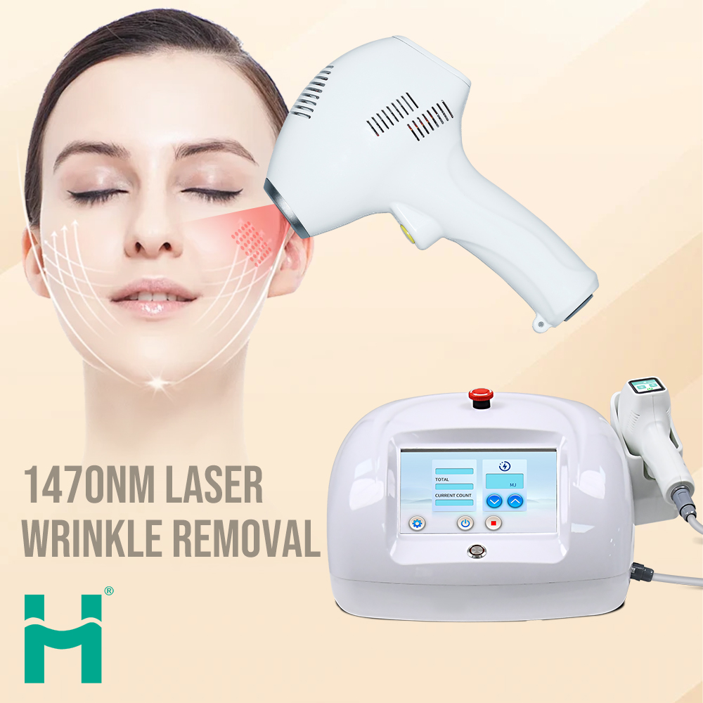 1470nm laser wrinkle removal Machine