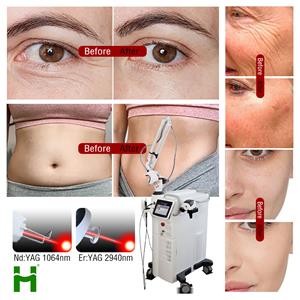 Er:YAG 2940nm+Nd:YAG 1064nm 2 IN 1 System